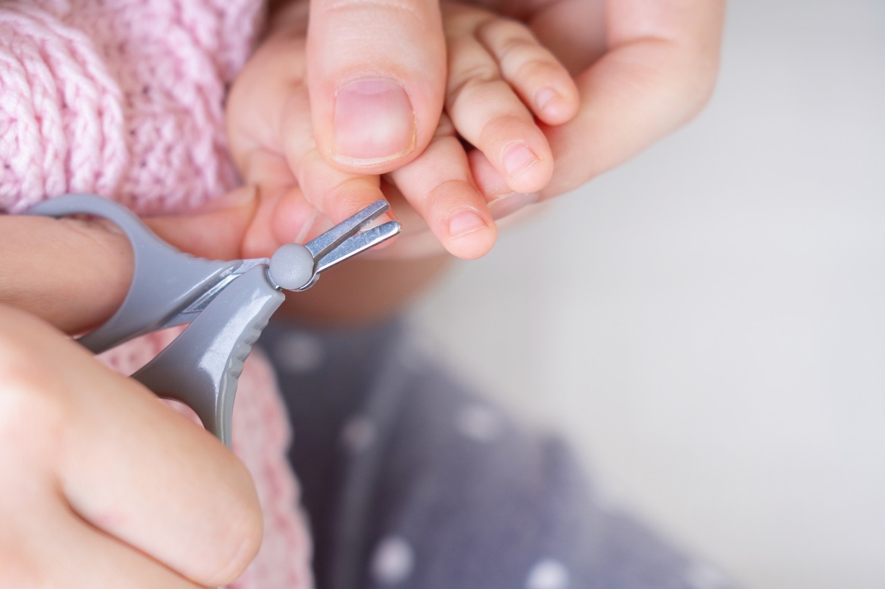 Cara Memotong Kuku Bayi Yang Aman. Berikut Panduan Dan Langkah-Langkahnya